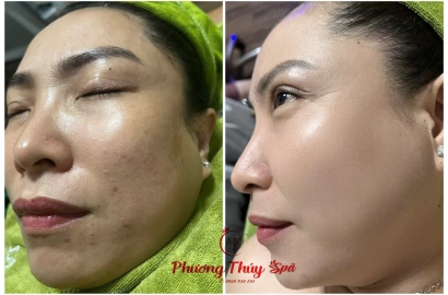 KHÁCH HÀNG 8