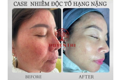 KHÁCH HÀNG 2
